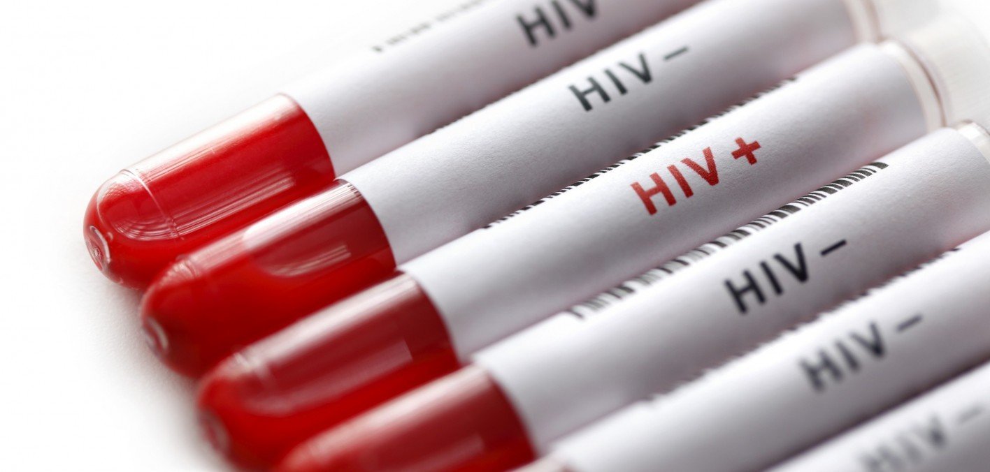 Почему в Молдове выросло число выявленных заражений ВИЧ? Все дело — в тестах
