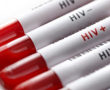 Fertilizarea in vitro, disponibilă pentru persoanele diagnosticate cu HIV. Ministerul Sănătății, Muncii și Protecției Sociale a semnat un ordin în acest sens