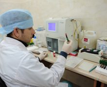 Где можно сделать ПЦР-тест на ковид за 300 леев? Гослаборатории в Кишиневе и других районах Молдовы