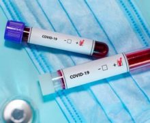 В Кишиневе бизнесмен передал врачам 500 тестов на коронавирус