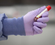 В Молдове 76 новых случаев заражения коронавирусом