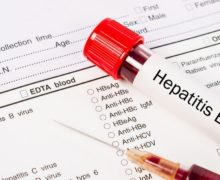 В Молдове появились экспресс-тесты на гепатит В и С
