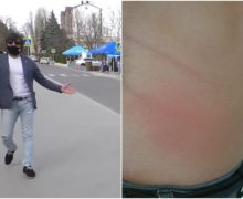 В Кишиневе владелец участка возле парка Афганцев ударил представителя мэрии из-за видеосъемки киосков