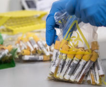 В Молдове еще у 1031 человека обнаружили коронавирус. В больницах умерли 8 пациентов с COVID