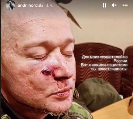 FOTO Solistul trupei Boombox, rănit în timpul bombardamentelor din Ucraina: apelul său către fanii din Rusia