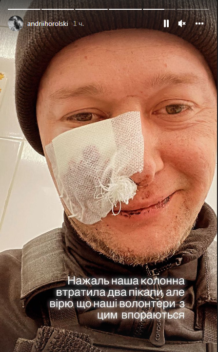 FOTO Solistul trupei Boombox, rănit în timpul bombardamentelor din Ucraina: apelul său către fanii din Rusia