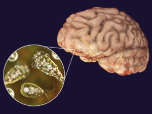 К чему снятся кошмары, и почему по миру распространяется амеба, поедающая мозг. Наука от NM по воскресеньям
