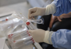 В Румынии выявили первый случай заражения новым штаммом коронавируса «кракен»