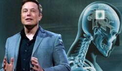 Elon Musk/cip Neuralink