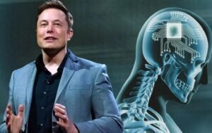 Elon Musk/cip Neuralink